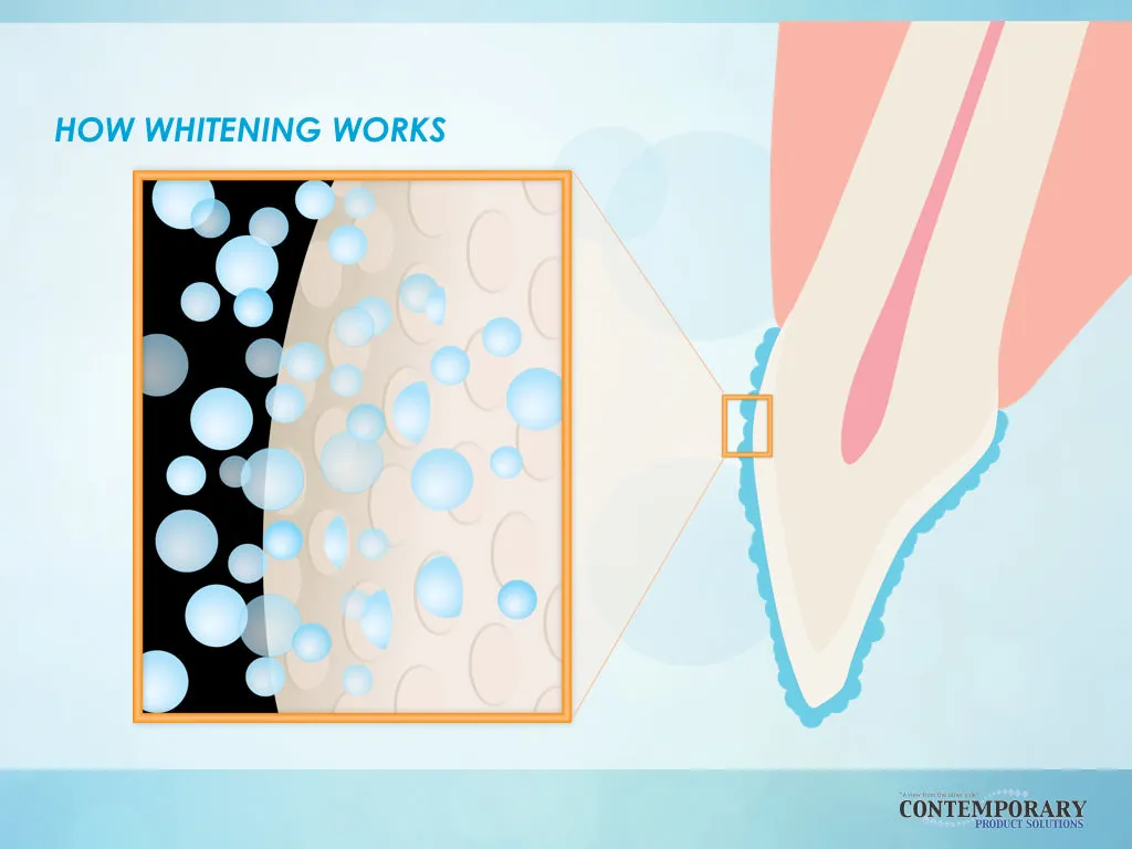 27120 teeth discoloration causes