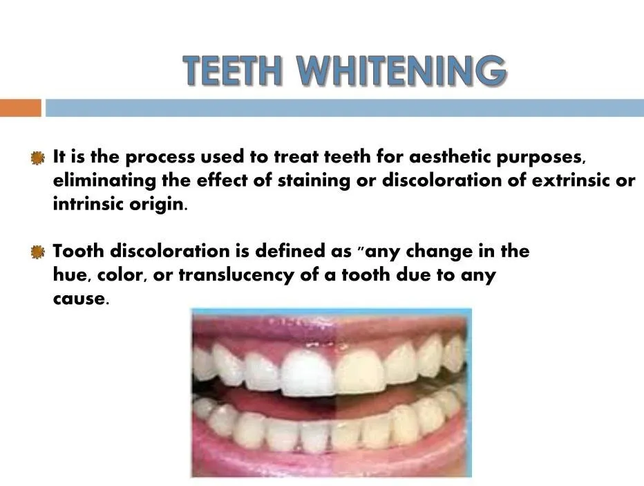 27120 teeth whitening process