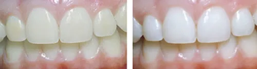 27120 tooth enamel structure