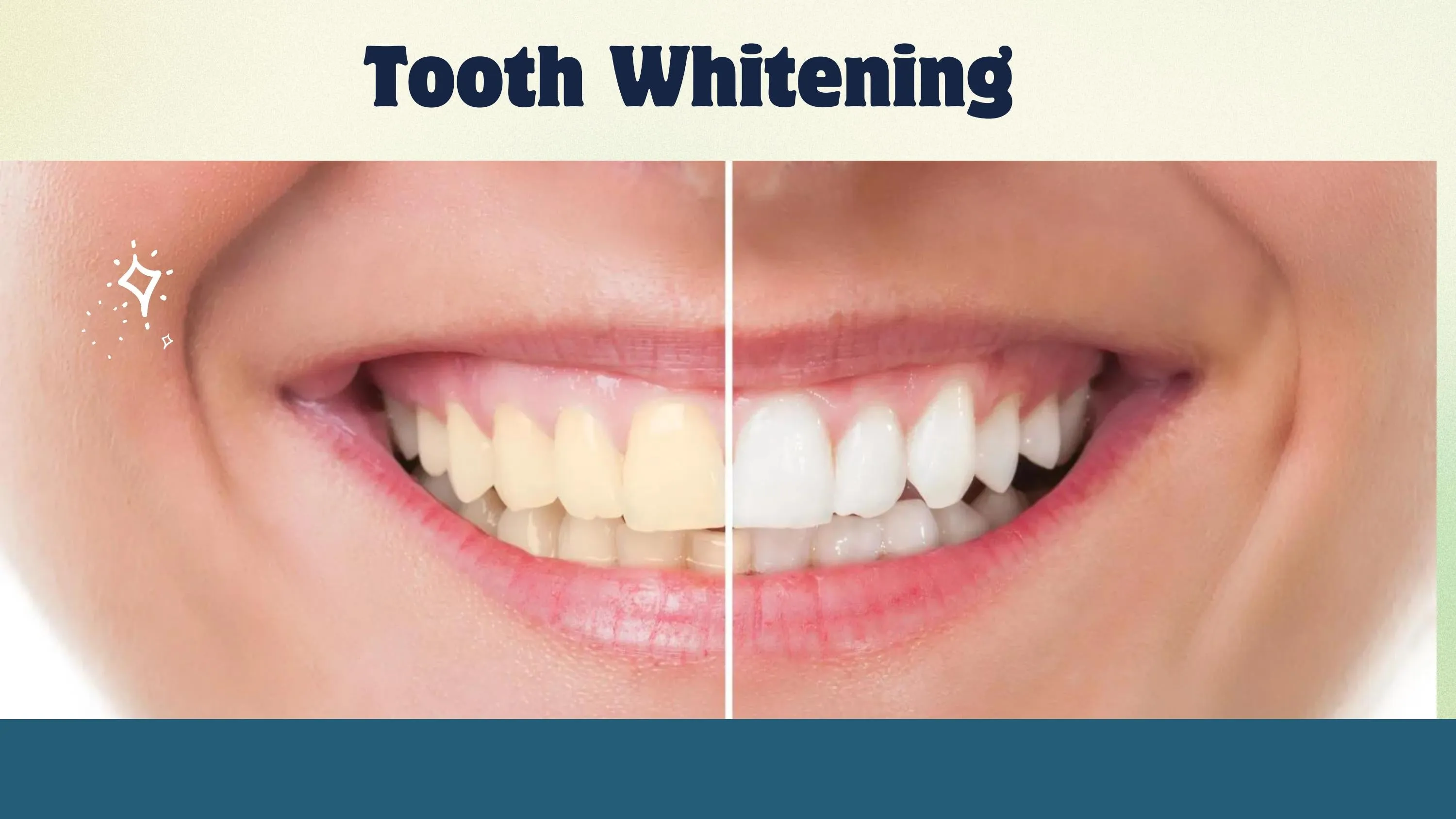 27122 north carolina tooth whitening oral hygiene