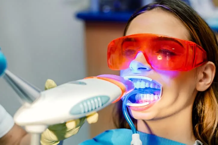 27125 professional teeth whitening
