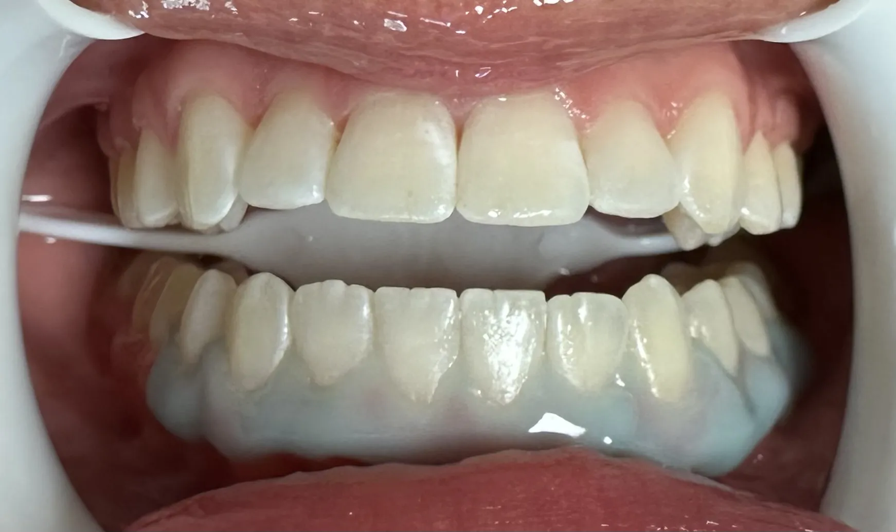 27133 glo blanc whitening peel ingredients