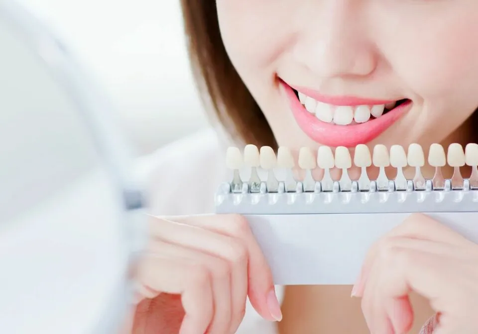 /img/27136-teeth-whitening-value.webp
