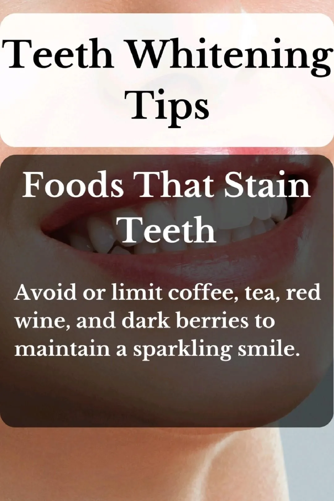 27138 professional teeth whitening