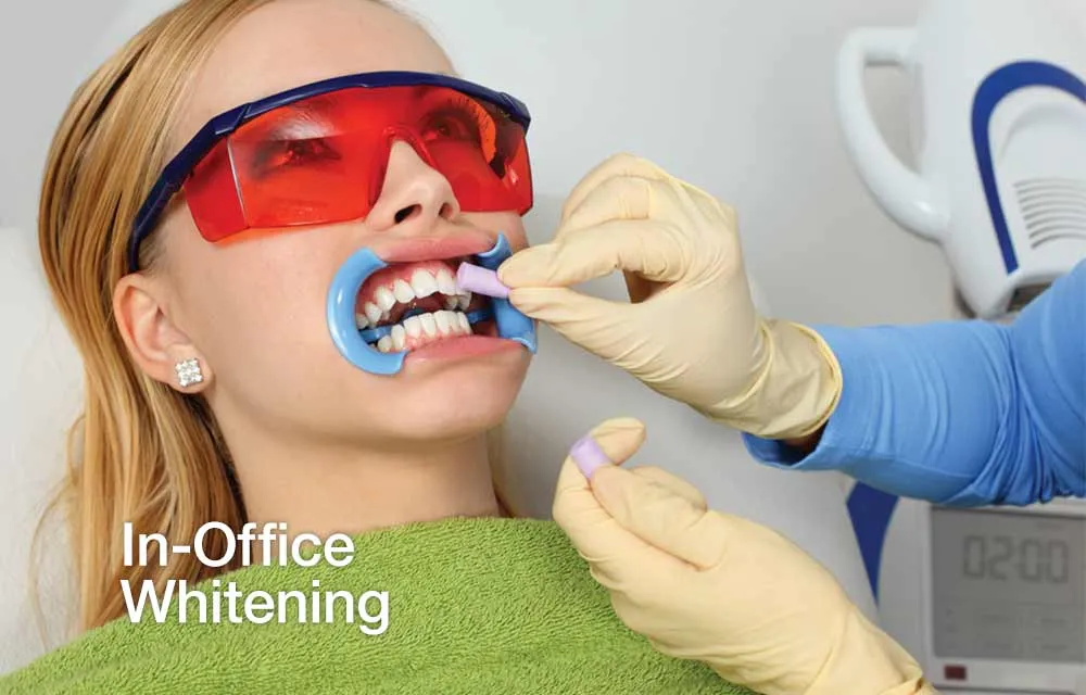 /img/27172-teeth-whitening-pricing.webp