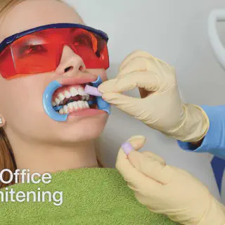 /img/27172-teeth-whitening-pricing.webp