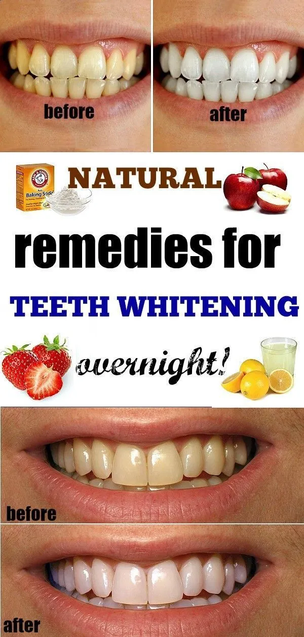 27175 teeth whitening instantly 4