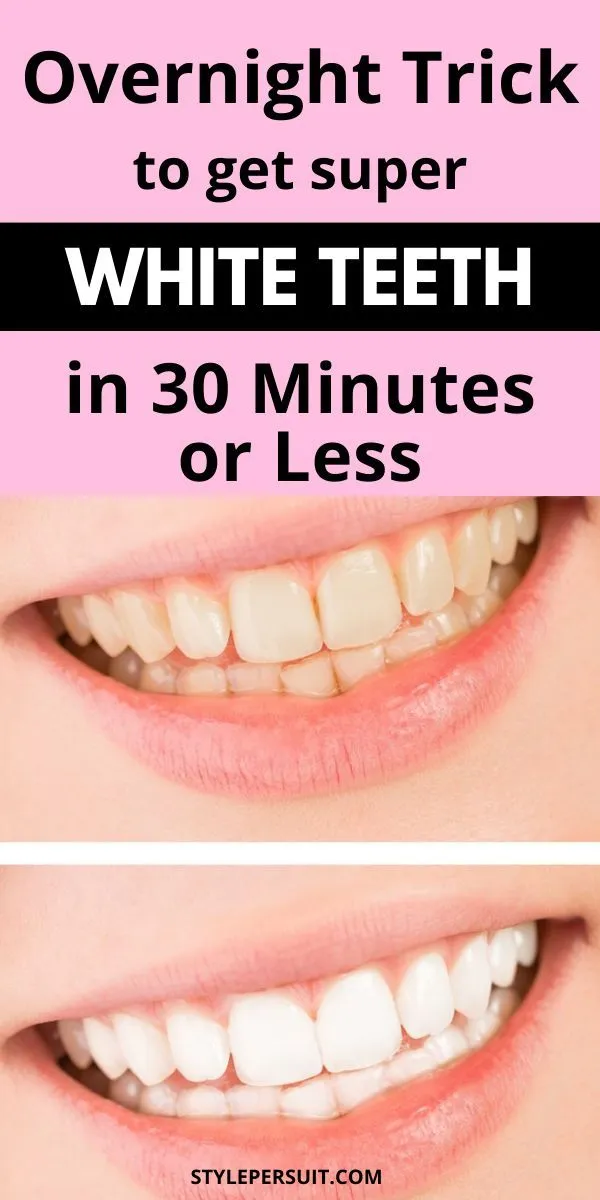 27175 teeth whitening instantly 5