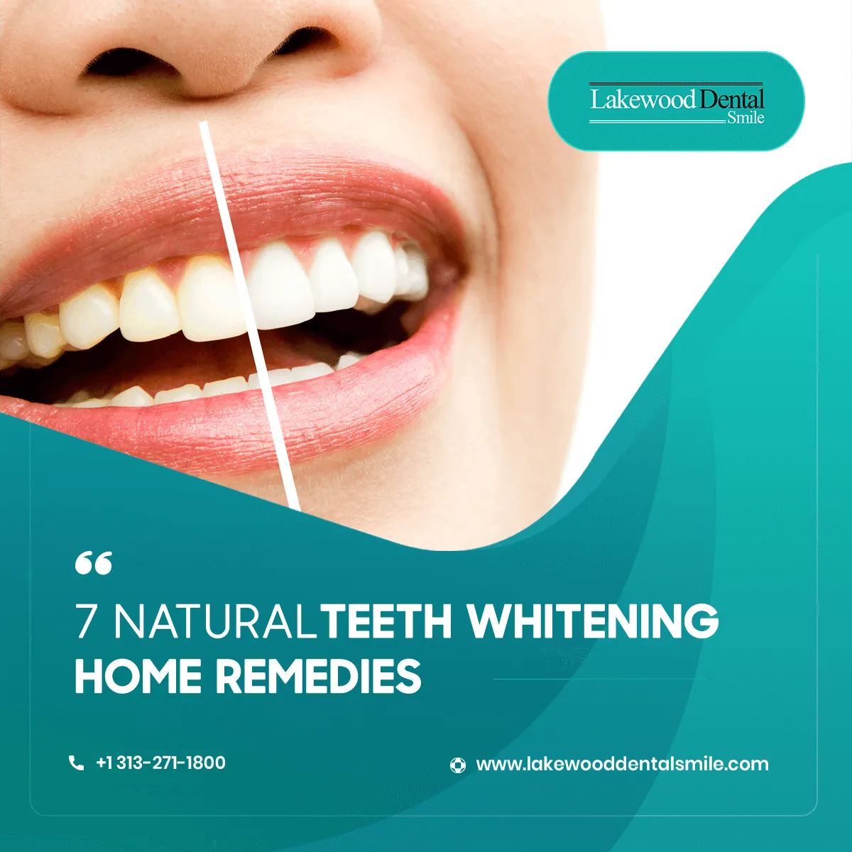 /img/27175-teeth-whitening-instantly-8.webp