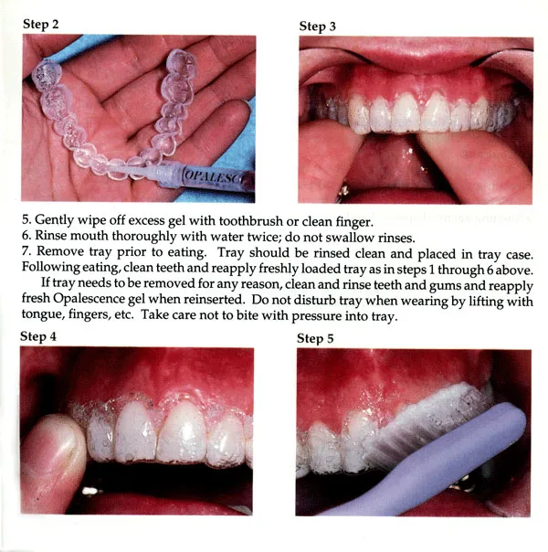 27187 rinsing whitening tray