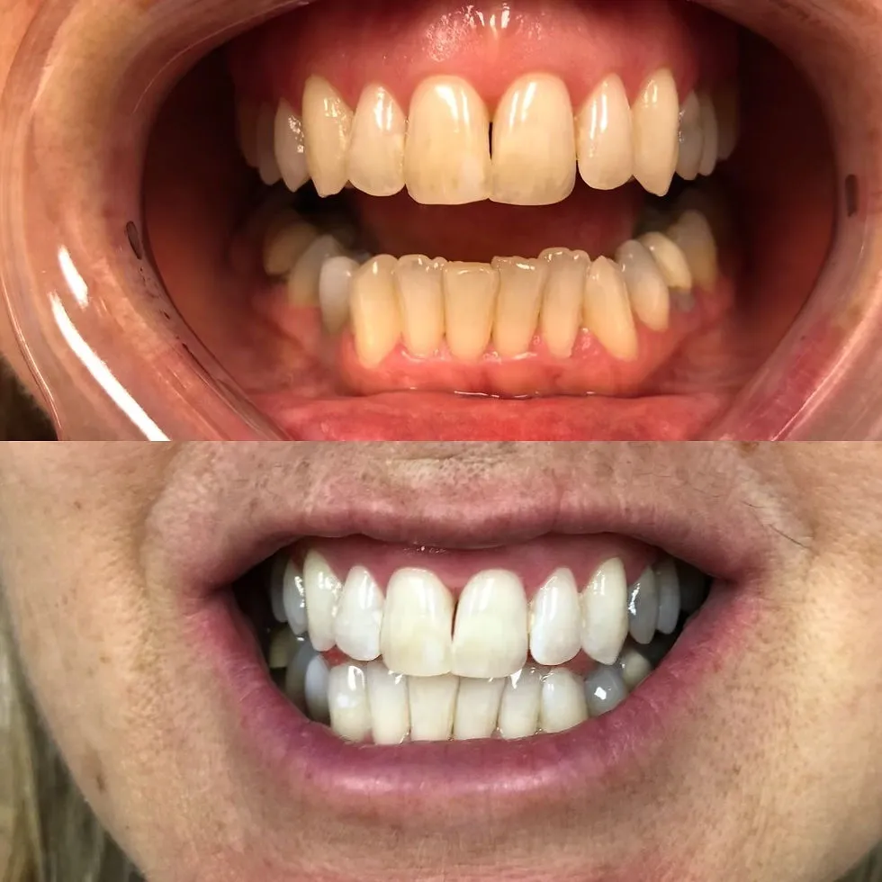 27197 dairy products teeth whitening