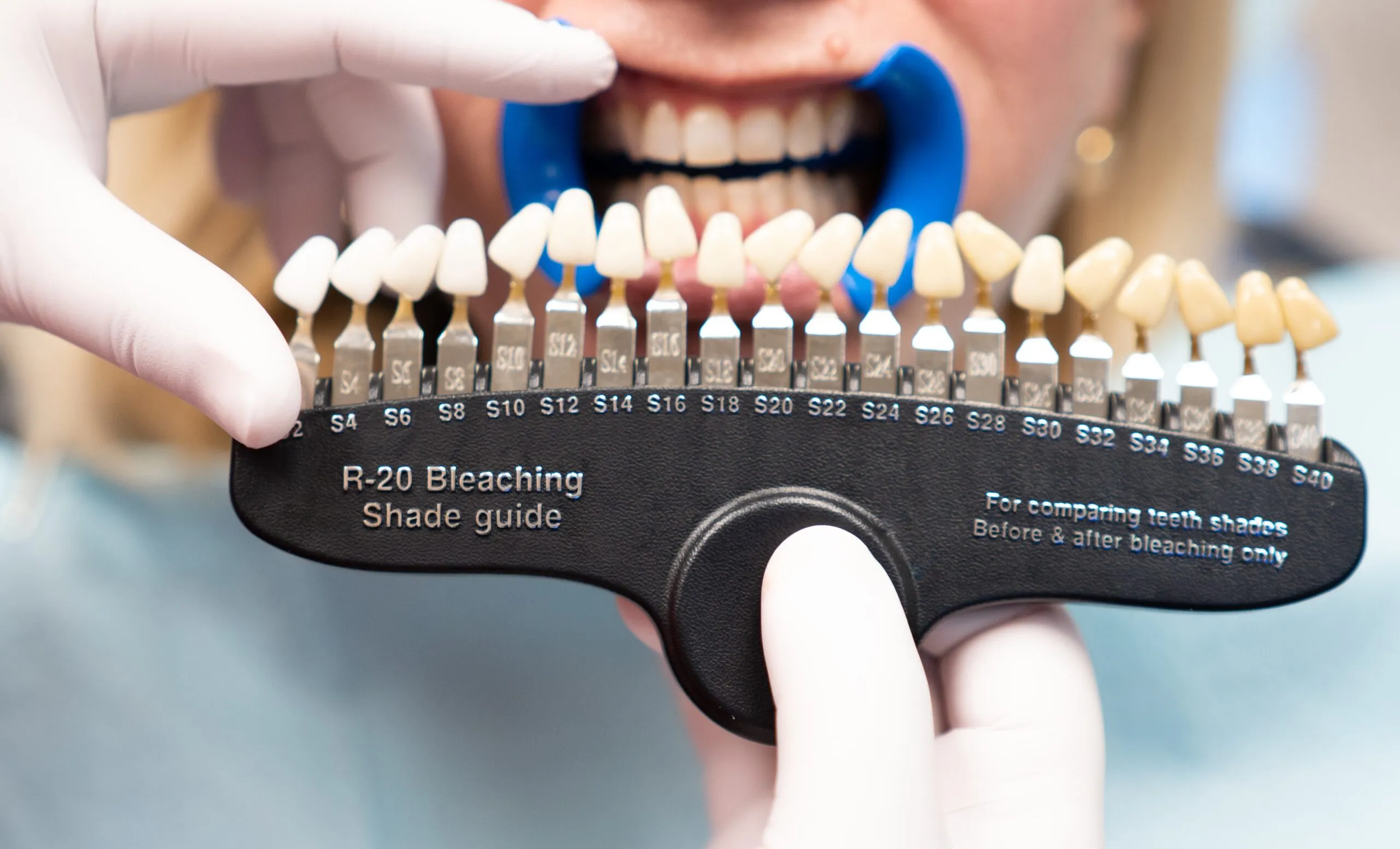 27207 teeth whitening stockton heath image2