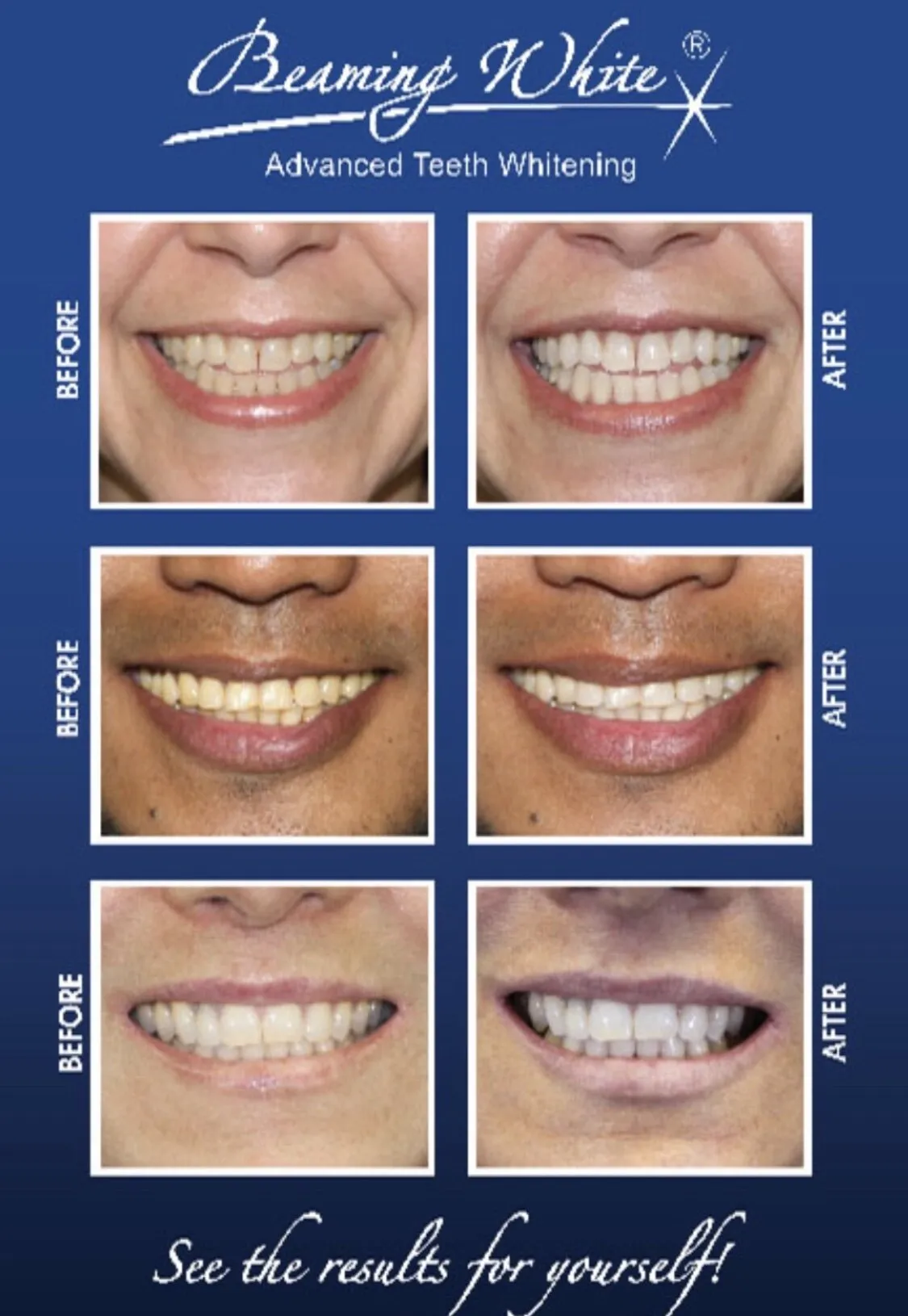 27207 teeth whitening stockton heath image7