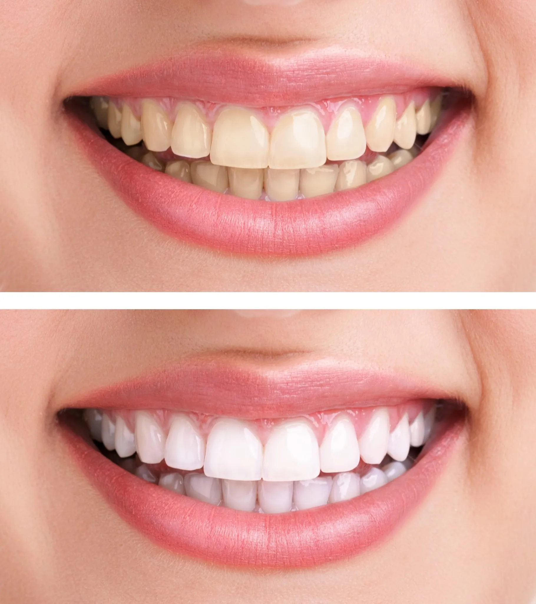 27210 bleachbright teeth whitening smile