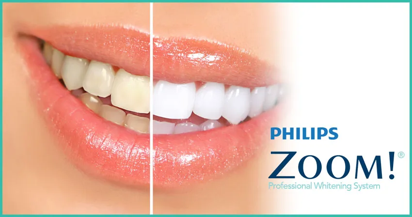 27230 teeth whitening comparison