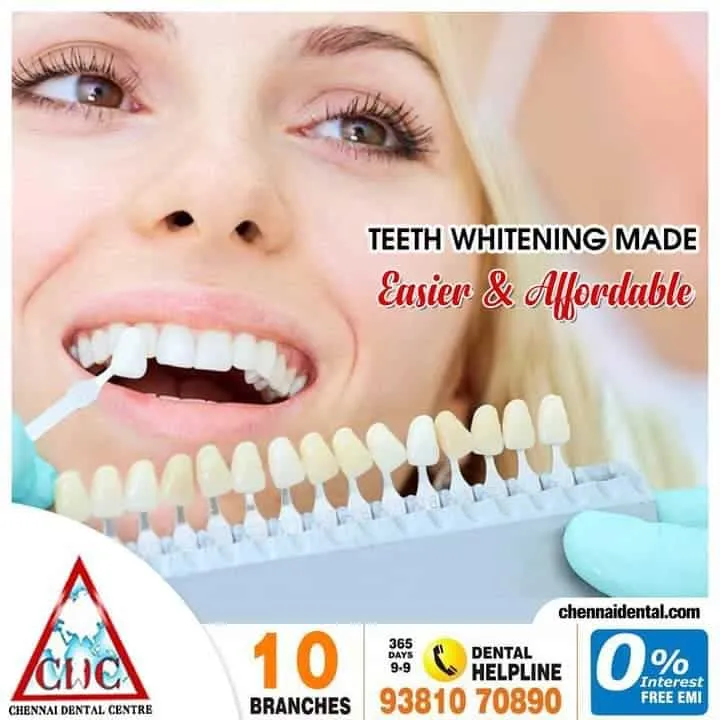 27242 teeth whitening bloomington il image5