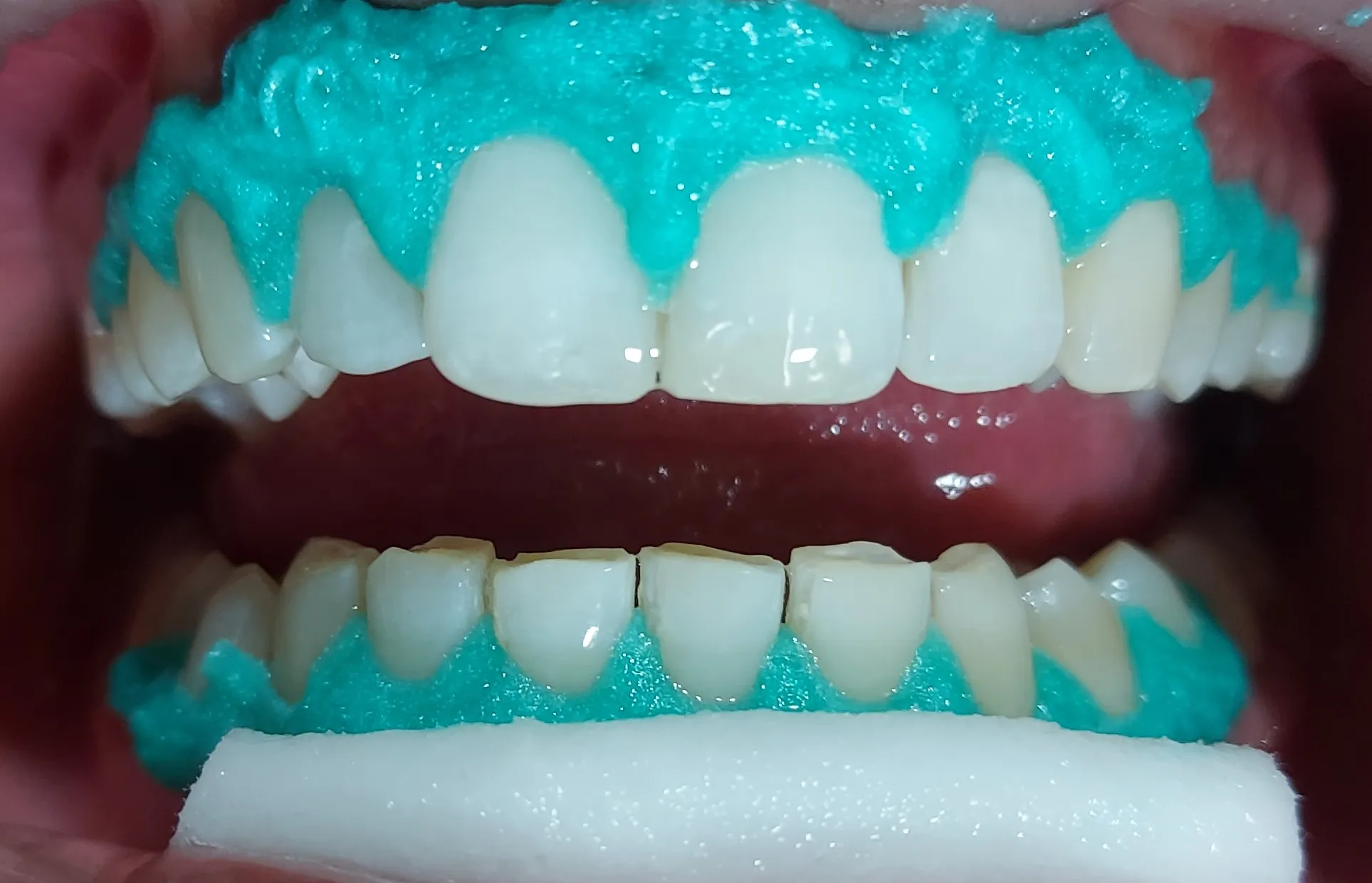 27244 healthy foods for teeth