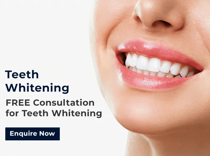 27247 teeth whitening cardiff before after