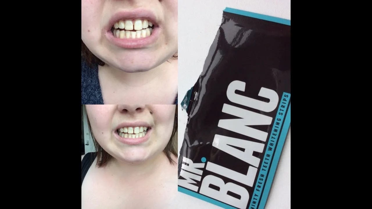 27266 teeth whitening ingredients