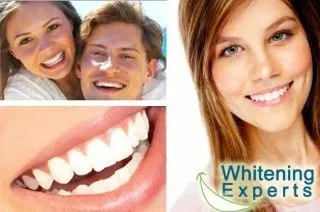 27274 teeth whitening birmingham deal1