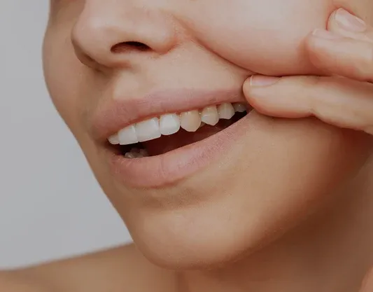 27276 teeth whitening touch up