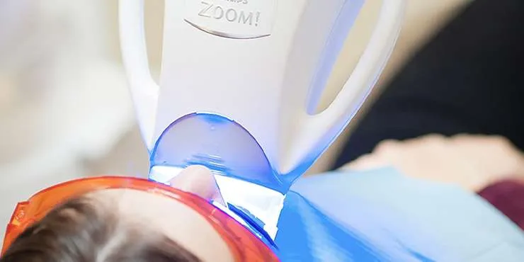 27282 zoom whitening baton rouge aftercare