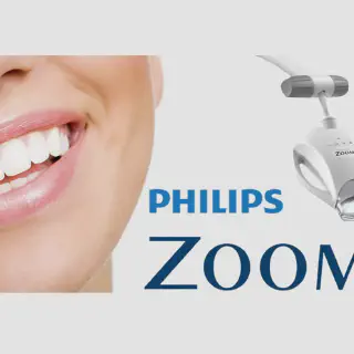 /img/27282-zoom-whitening-baton-rouge-consultation.webp