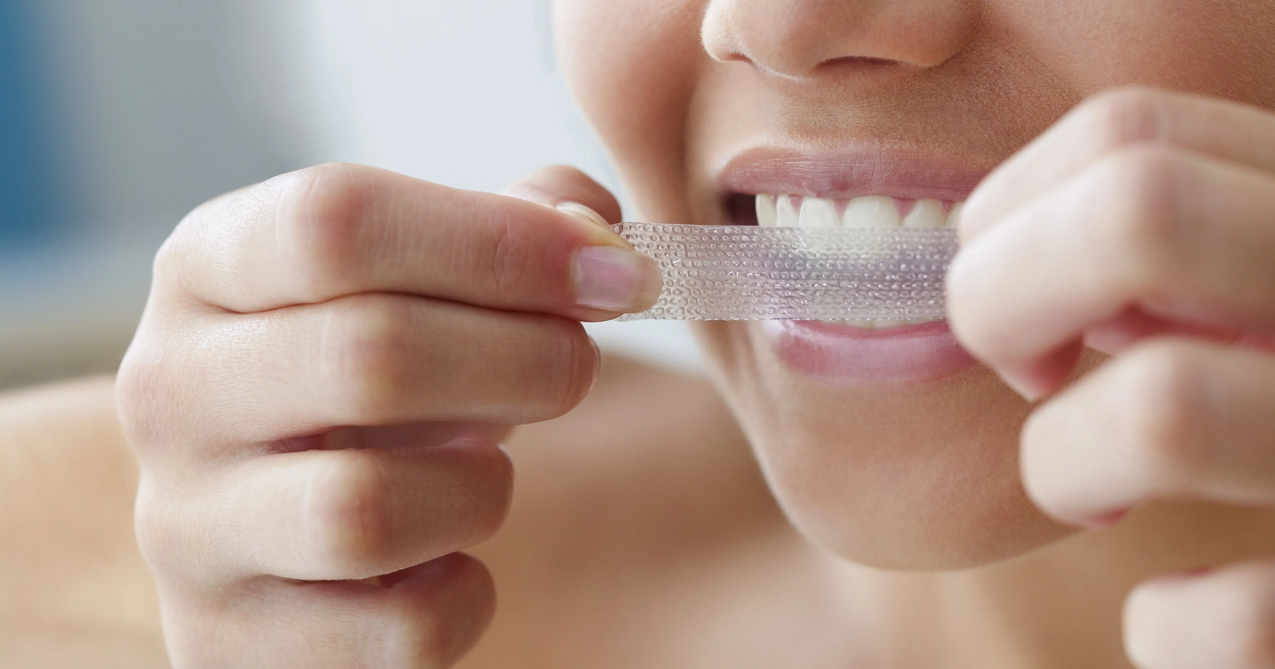 27284 tooth sensitivity after whitening 1