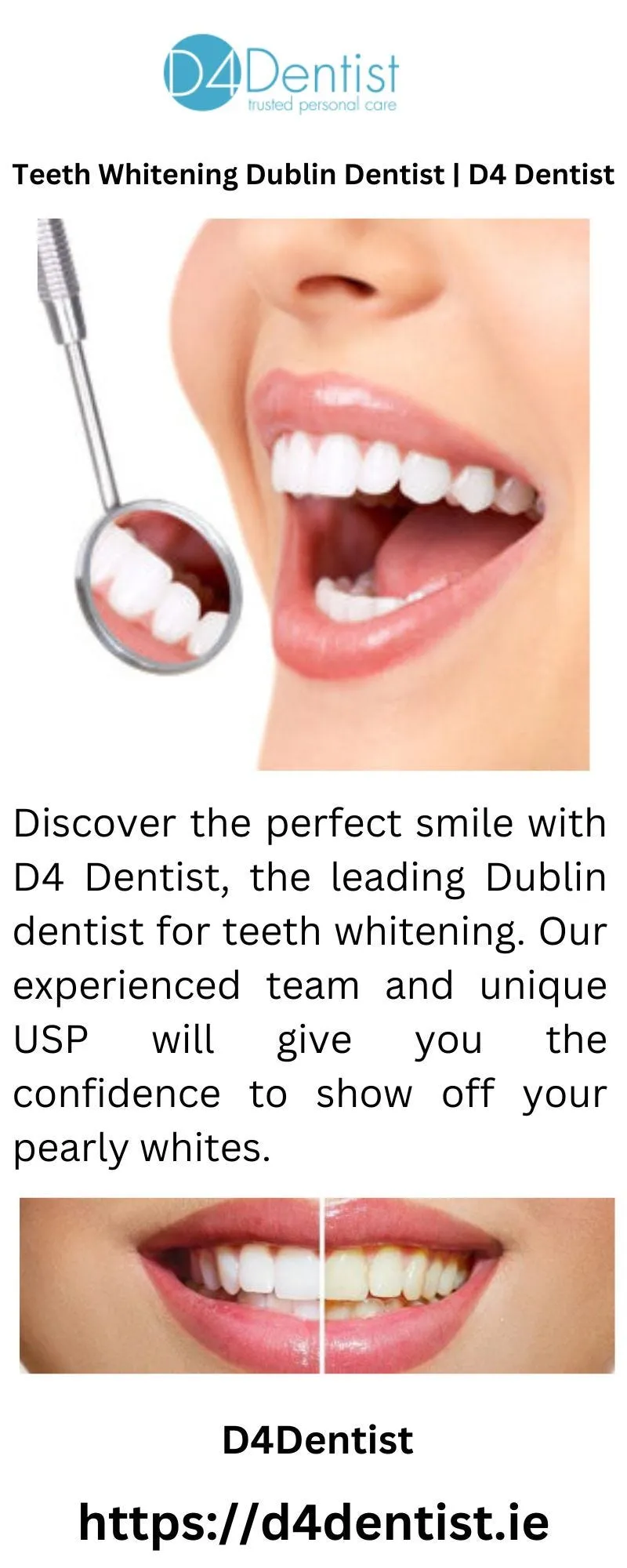 /img/27293-teeth-whitening-success.webp