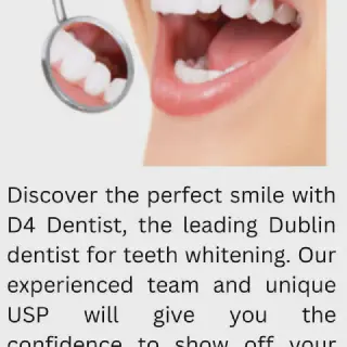/img/27293-teeth-whitening-success.webp