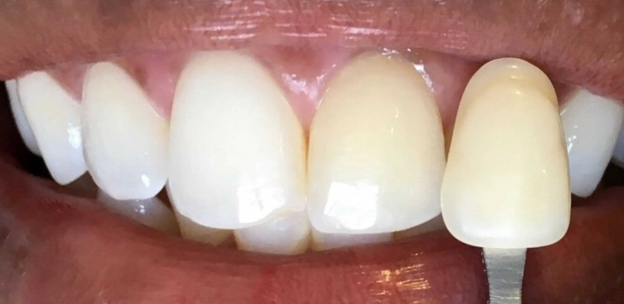 27296 teeth whitening toothpaste