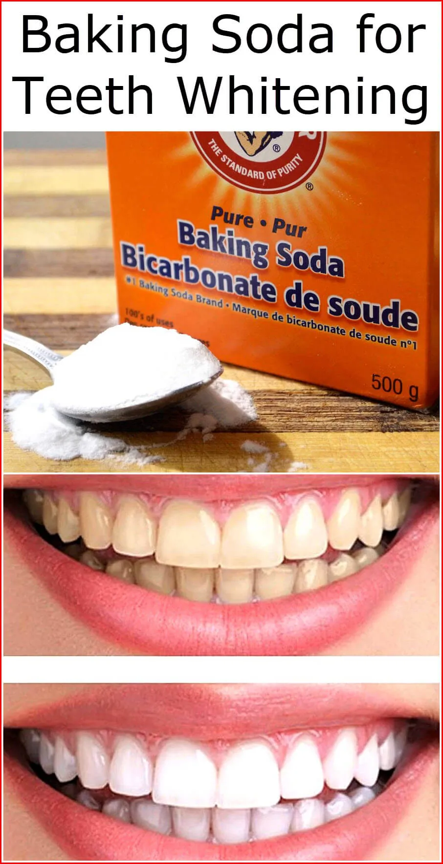 /img/27306-professional-teeth-whitening.webp
