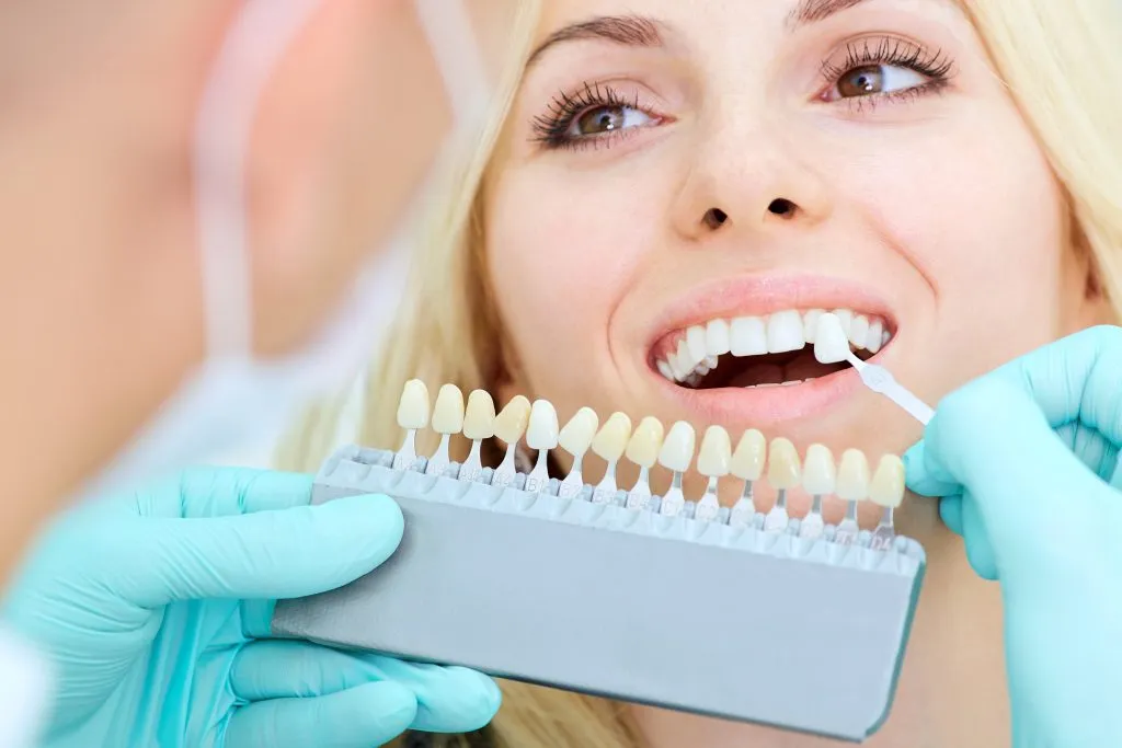 /img/27318-teeth-whitening-cost-effectiveness.webp