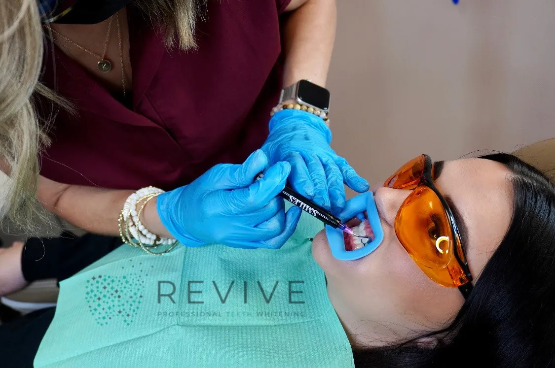 27327 in office teeth whitening