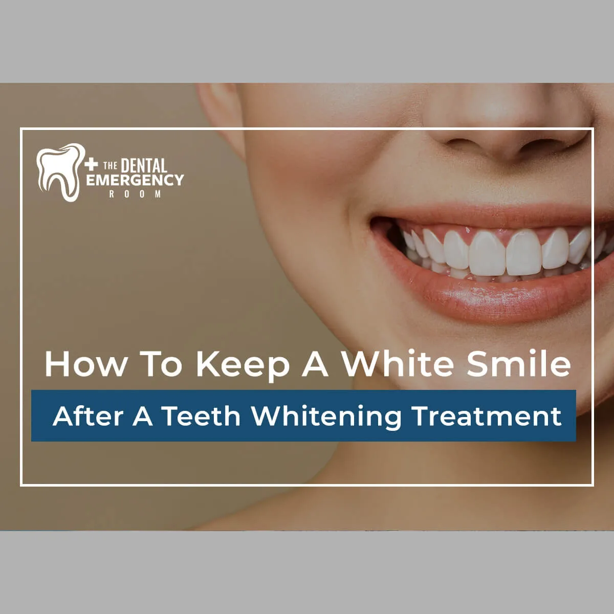 27336 teeth whitening procedure