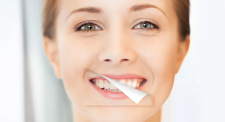 27341 teeth whitening thailand overview