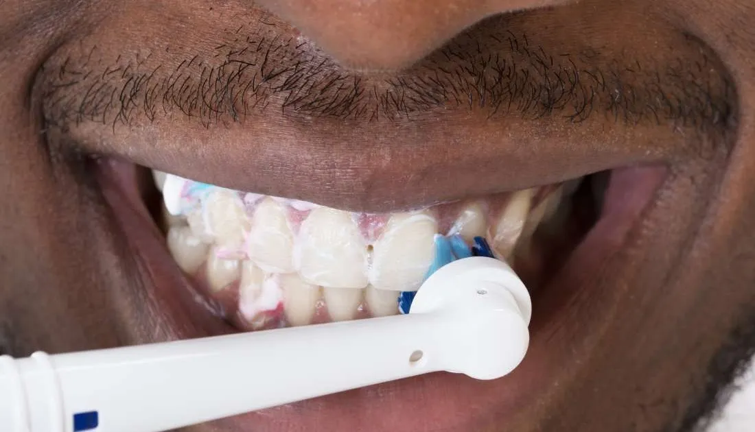 27352 byte teeth whitening kit