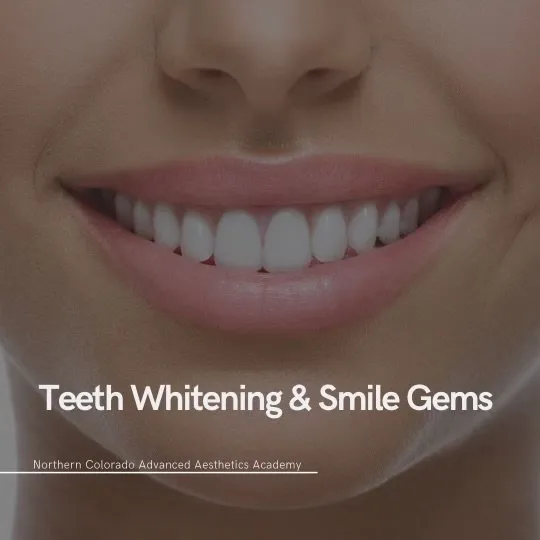/img/27354-idaho-smiles-teeth-whitening-long-lasting.webp