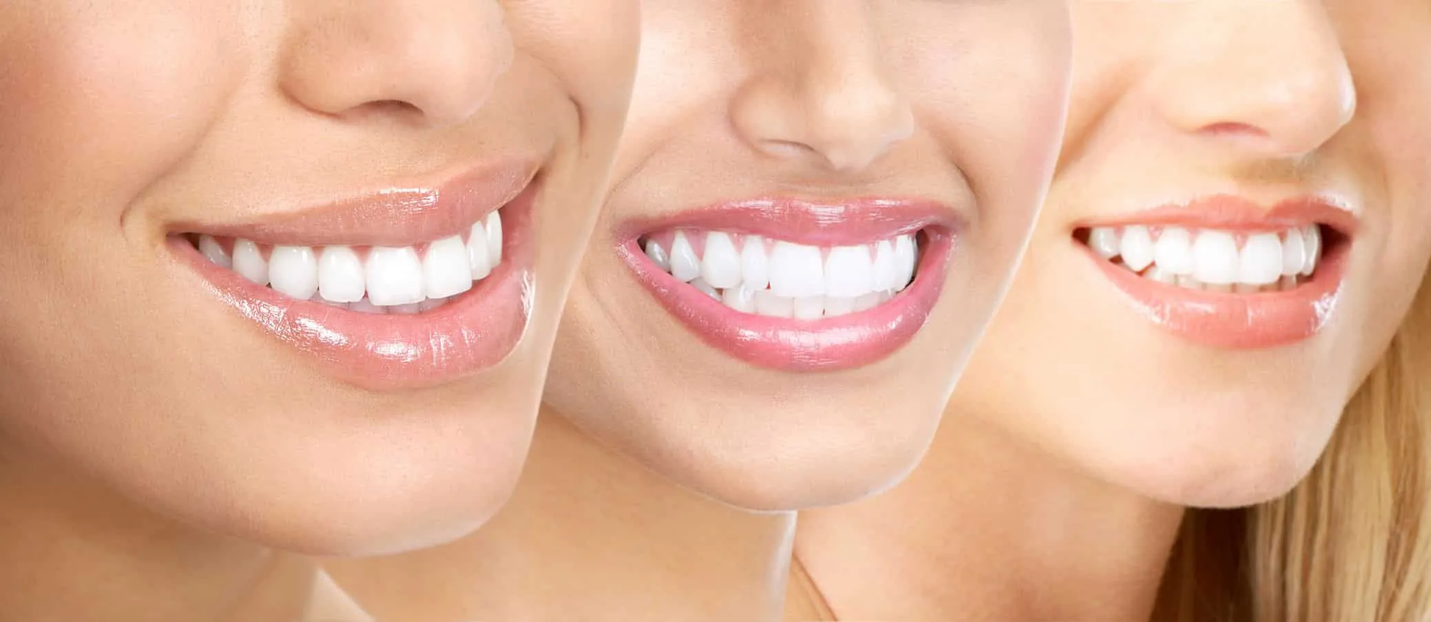 27354 idaho smiles teeth whitening stain removal