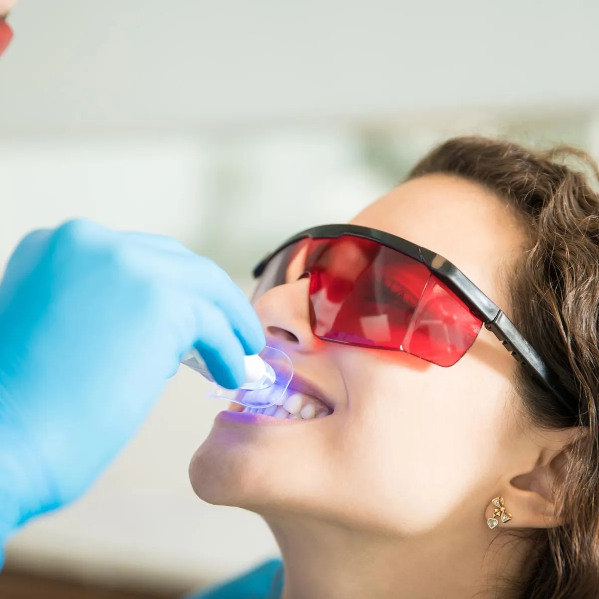 27355 in office teeth whitening