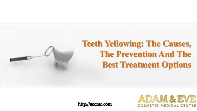 27355 teeth whitening abu dhabi smiling
