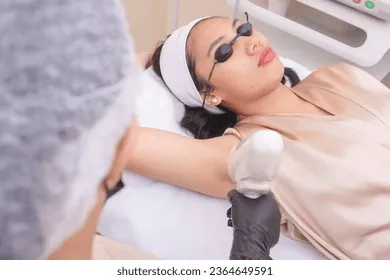 27356 chemical peel underarm