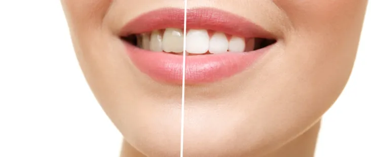 27371 professional dental care