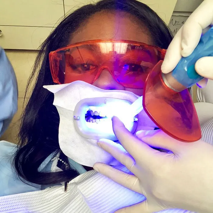 27373 laser teeth whitening image6