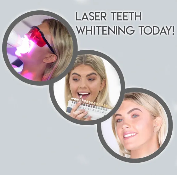 27381 laser teeth whitening procedure