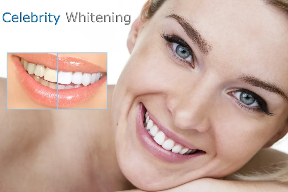 27383 whitening toothpaste