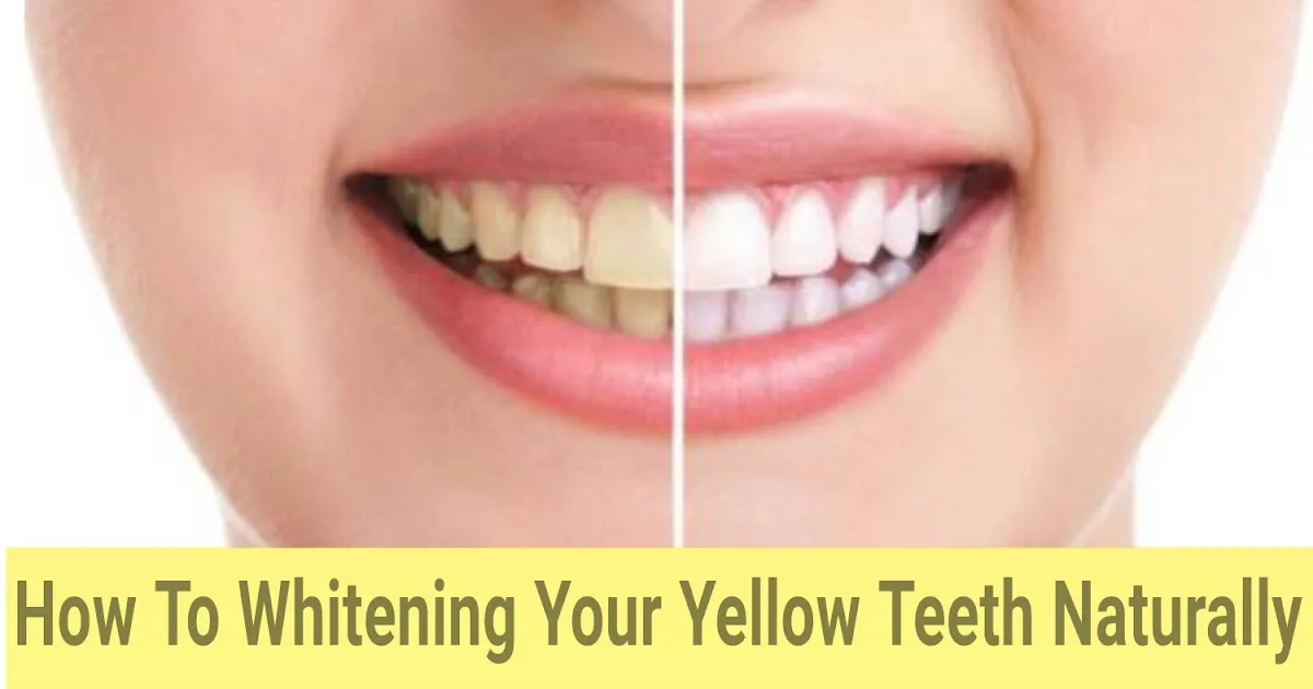 /img/27392-teeth-whitening-results.webp