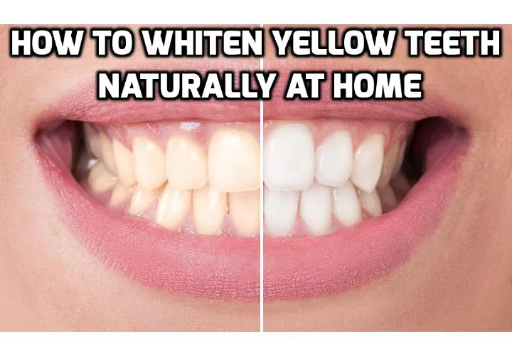 27392 teeth whitening tips