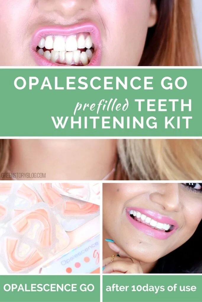 27398 sensitive teeth after whitening
