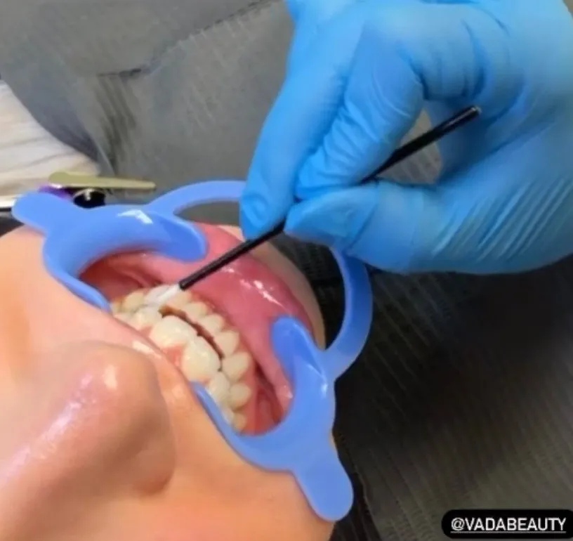 27401 sensitive teeth care